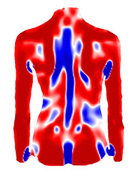 3-D Wirbelsäulenvermessung